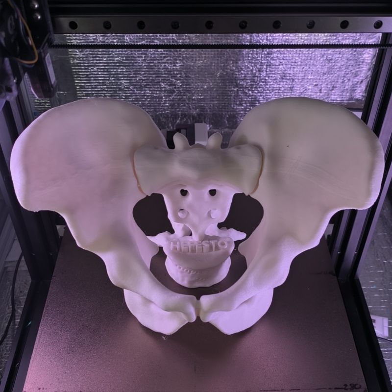 Pelvis completa — vista superior